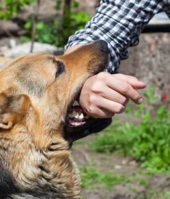 Chó dại cắn tay người
