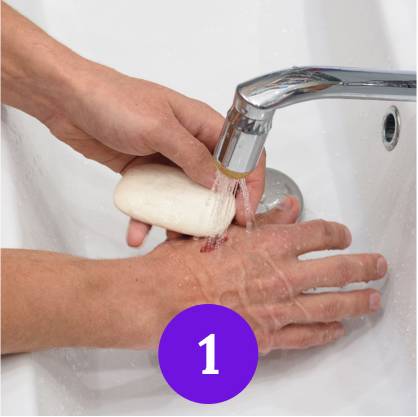 Xử lý động vật cắn bước 1