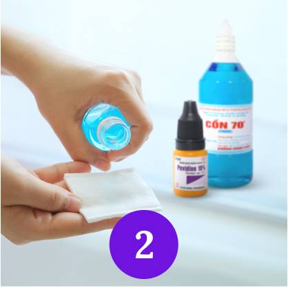 Xử lý động vật cắn bước 2